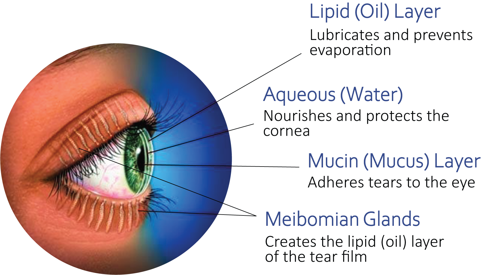 Dry Eye Fraser Valley Cataract Laser Dry Eye Fraser Valley Cataract Laser