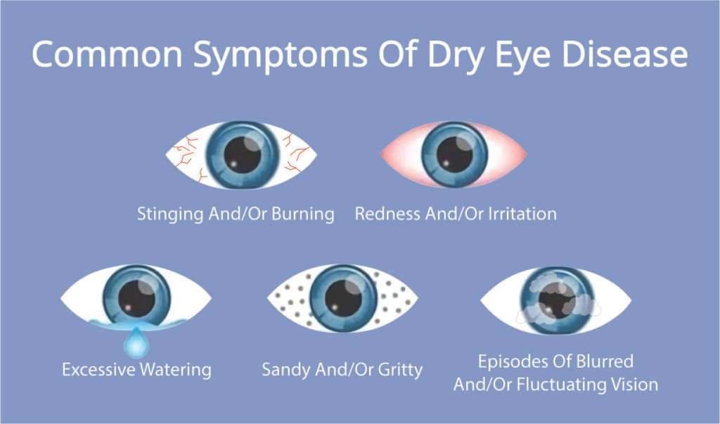 Close-up of a red, irritated eye showing common dry eye disease symptoms