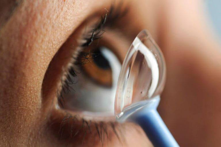 Scleral contact lens held on a fingertip before insertion