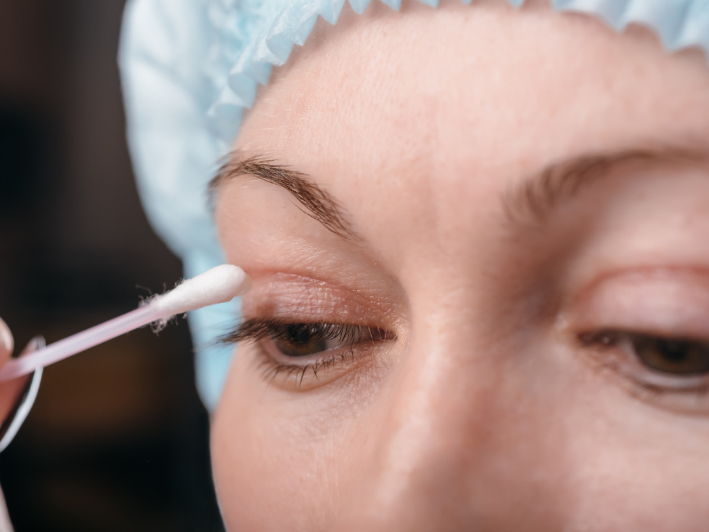 Close-up of a patient's upper eyelid being prepared with a cotton swab before an eyelid procedure